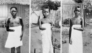 bambini congolesi mutilati dai belgi