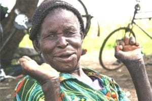 E il contagio non avviene tramite semplice contatto occasionale con i malati, ma la maggior parte dei casi si verifica dopo un contatto prolungato. 