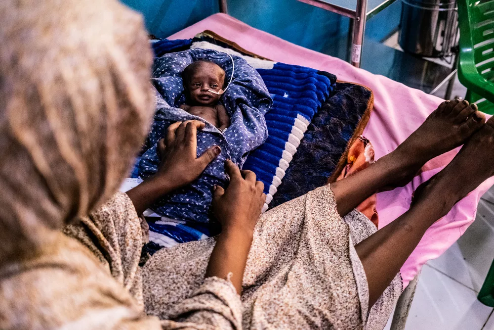 Una madre guarda sua figlia di 20 settimane nell'unità di terapia intensiva neonatale. @Tadeu Andre/MSF